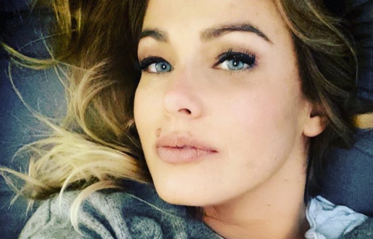 Sonia Bruganelli si mostra con l'herpes