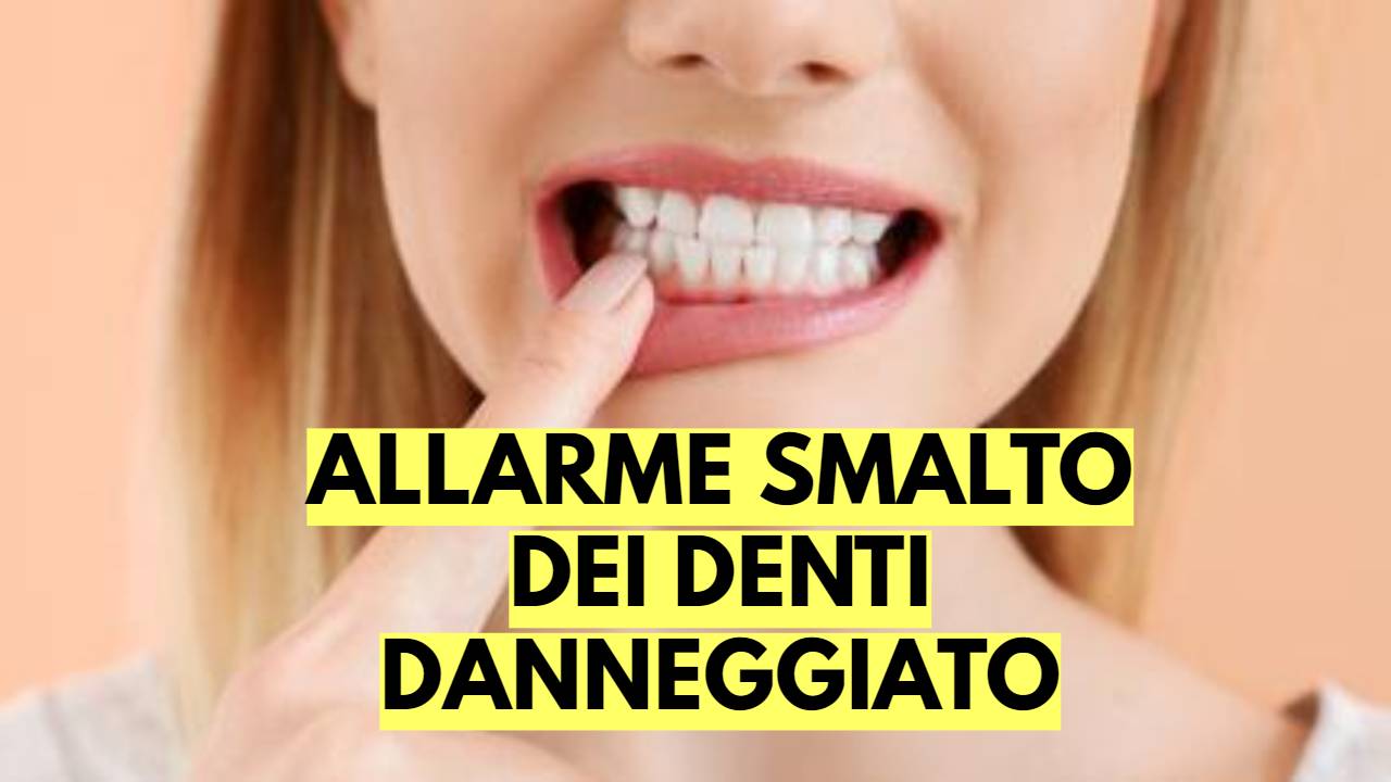 Smalto denti Direttanews.com 03_10_22 (1)
